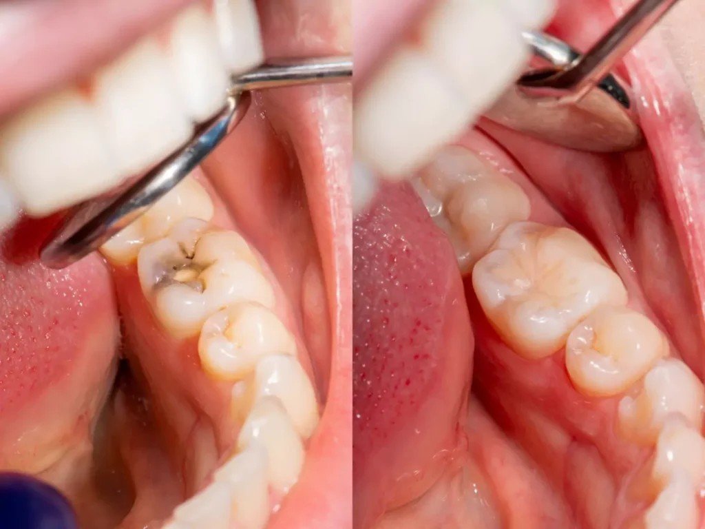 Dentist In Diamond Bar: Diamond Bar Dental Studio