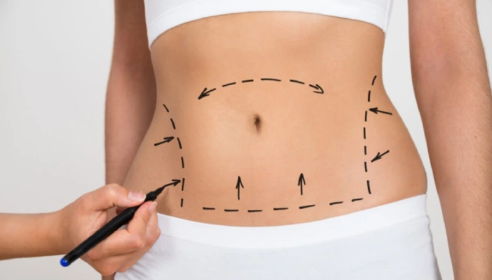 Tummy-Tuck-Surgery-Mjumbai