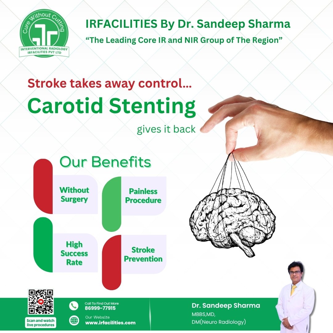 Carotid Artery Stenting for Stroke Prevention