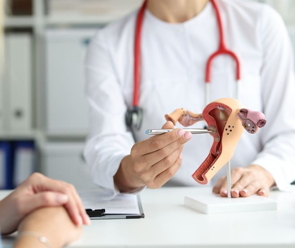 fibroid-ayurvedic-treatment-in-delhi