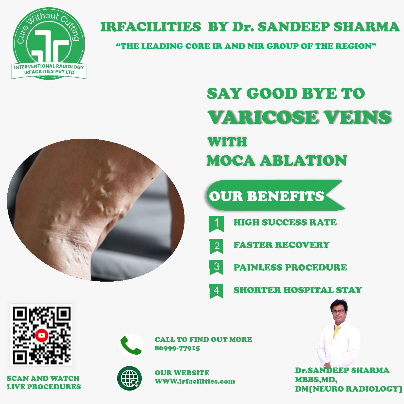 Best Hospital for Varicose Vein Treatment in India – Advanced Care You Can Trust