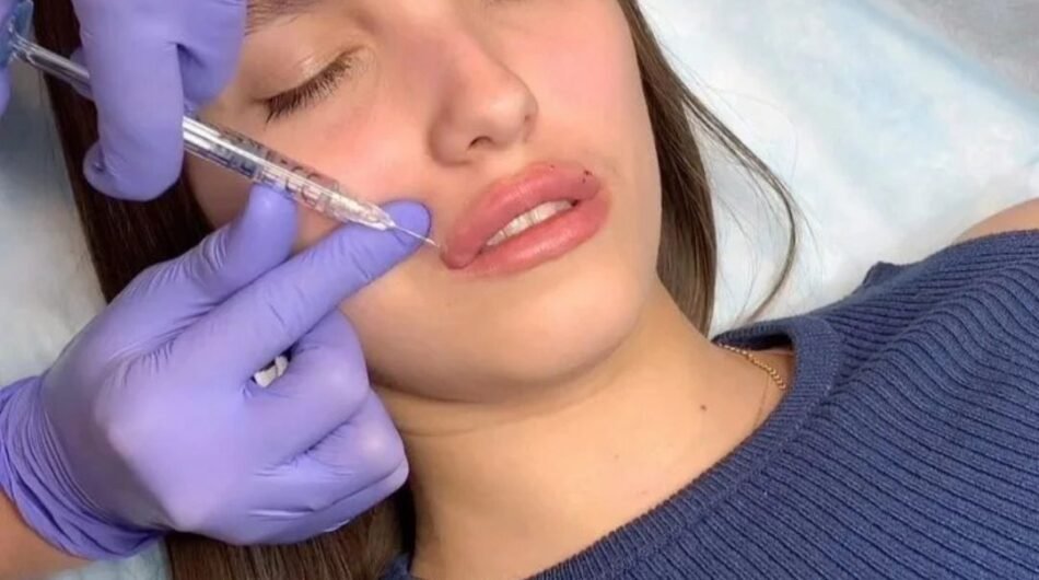 Beverly-Hills-Botox-Consultants