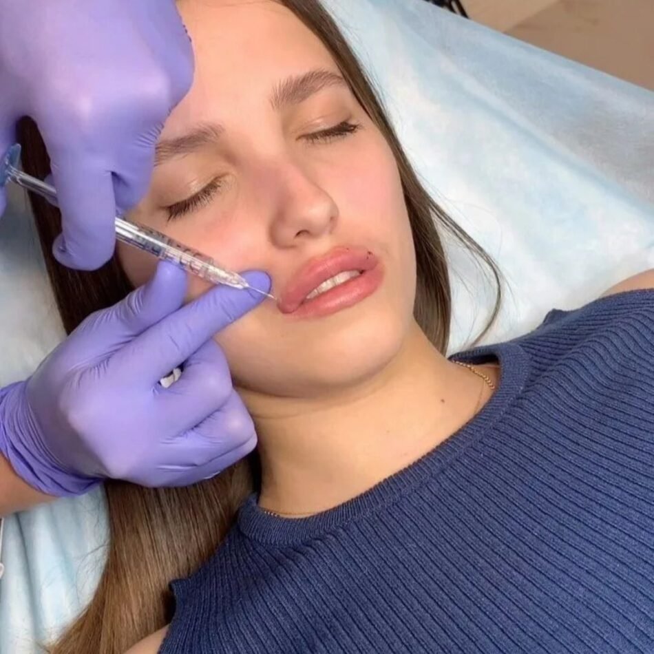 Beverly-Hills-Botox-Consultants