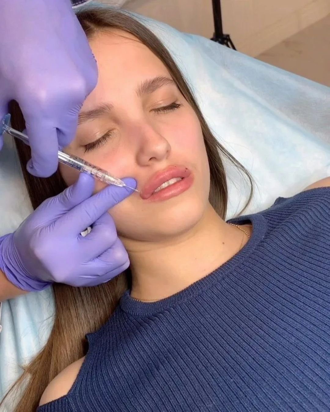 Beverly Hills Botox Consultants