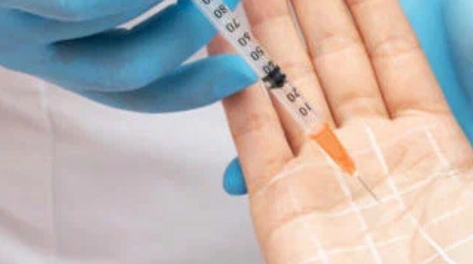Botox-For-Hyperhidrosis-Hands