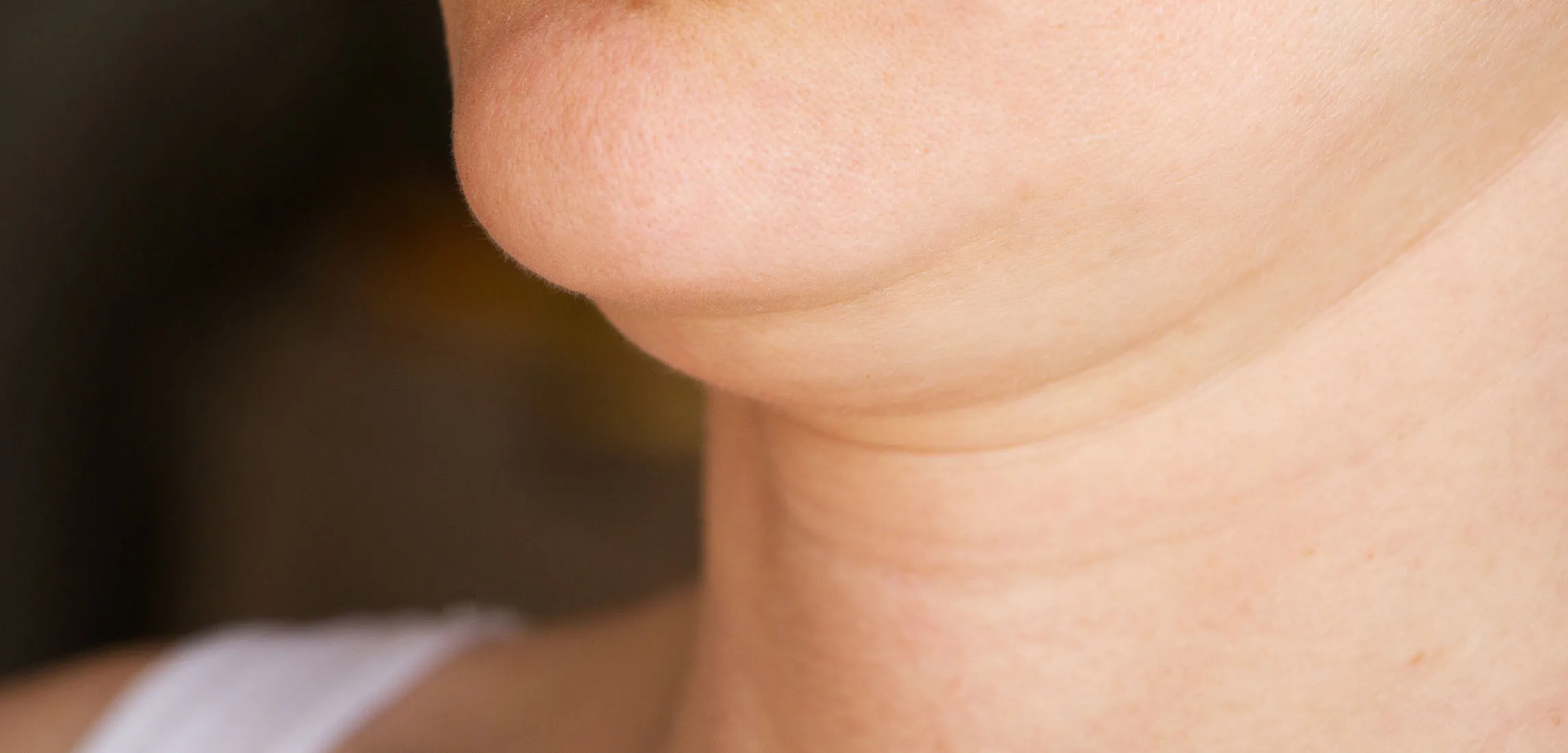 Double Chin Treatment in Vancouver | Euro Charm Skincare and Body Clinic