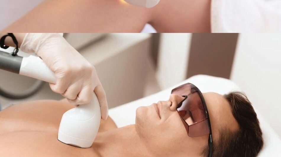 Laser-Hair-Removal-8