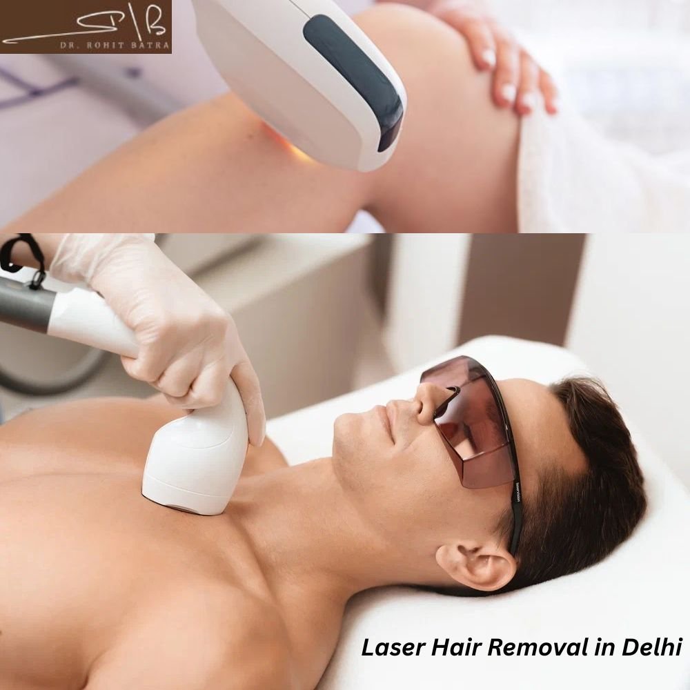 Advanced Laser Hair Reduction Treatments by Dr. Rohit Batra