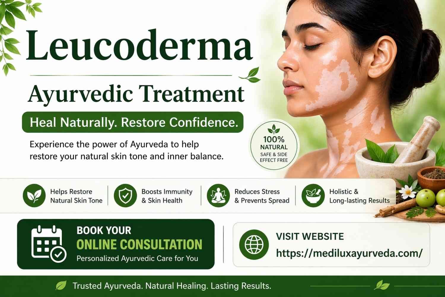 Leucoderma Ayurvedic Treatment | Natural Skin Care – MediLux Ayurveda