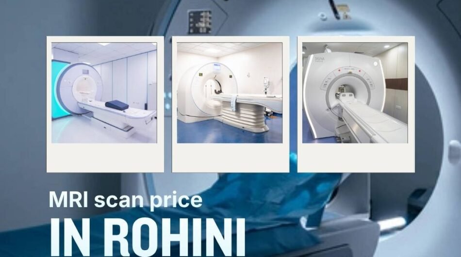 MRI-scan-price-in-Rohini