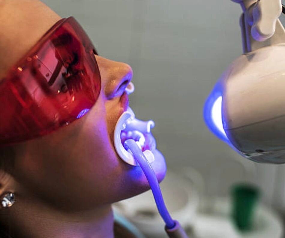 Philips-Zoom-Whitening-in-Mount-Roskill-Auckland