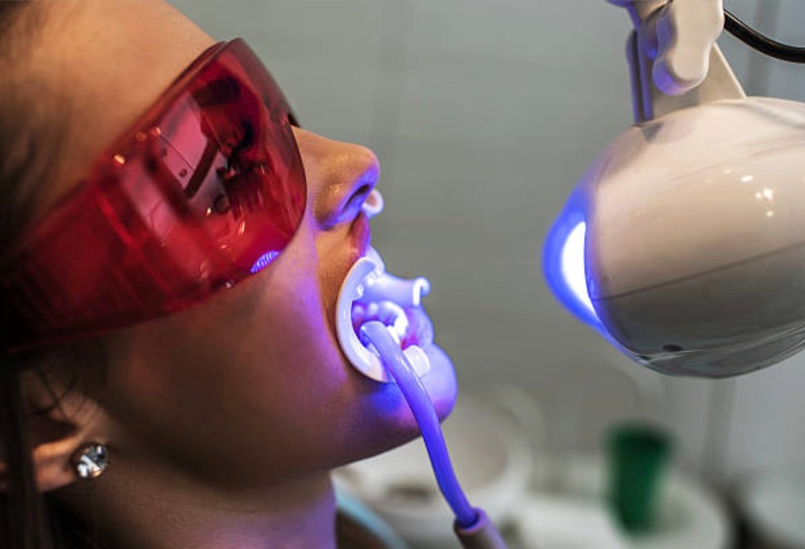 Philips Zoom Whitening in Mount Roskill, Auckland