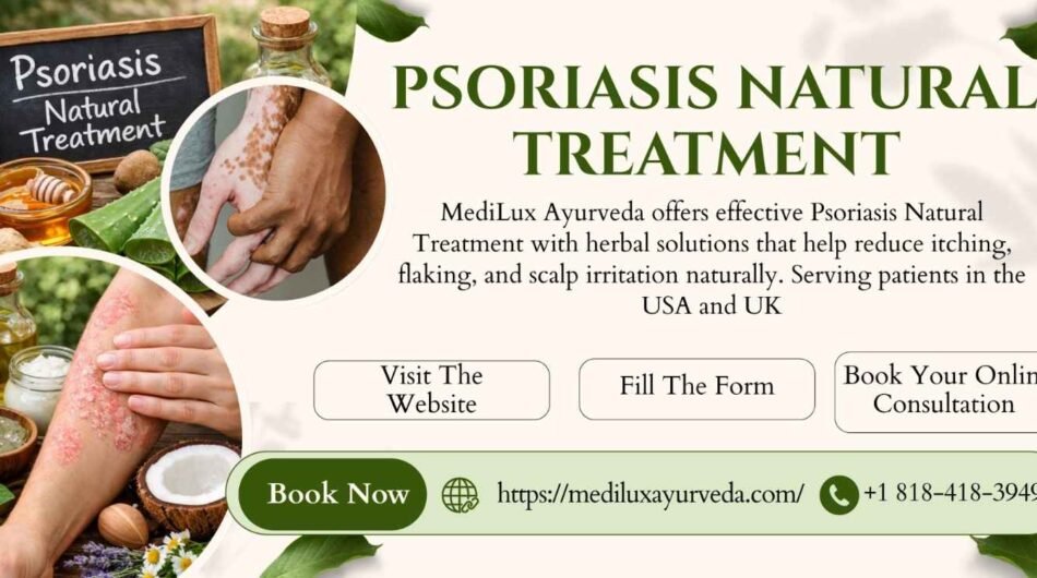 Psoriasis-Natural-Treatment