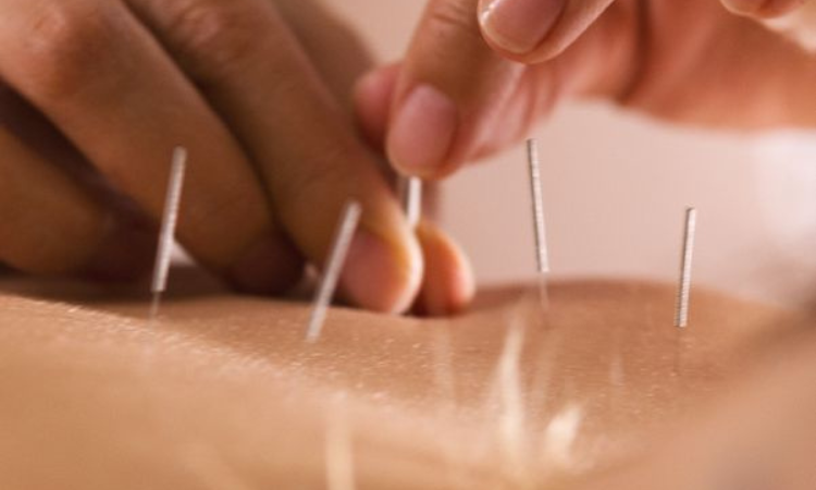 InMotion Acupuncture