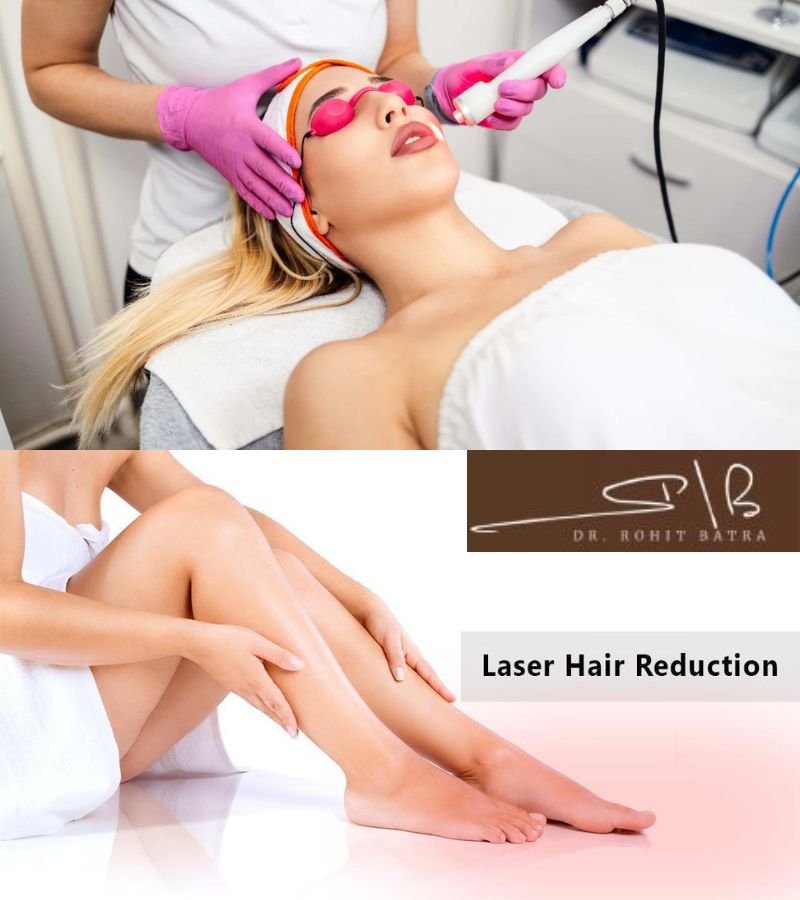 Laser Hair Reduction in Delhi with experts