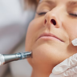 skin-laxity-treatment-fort-collins-1