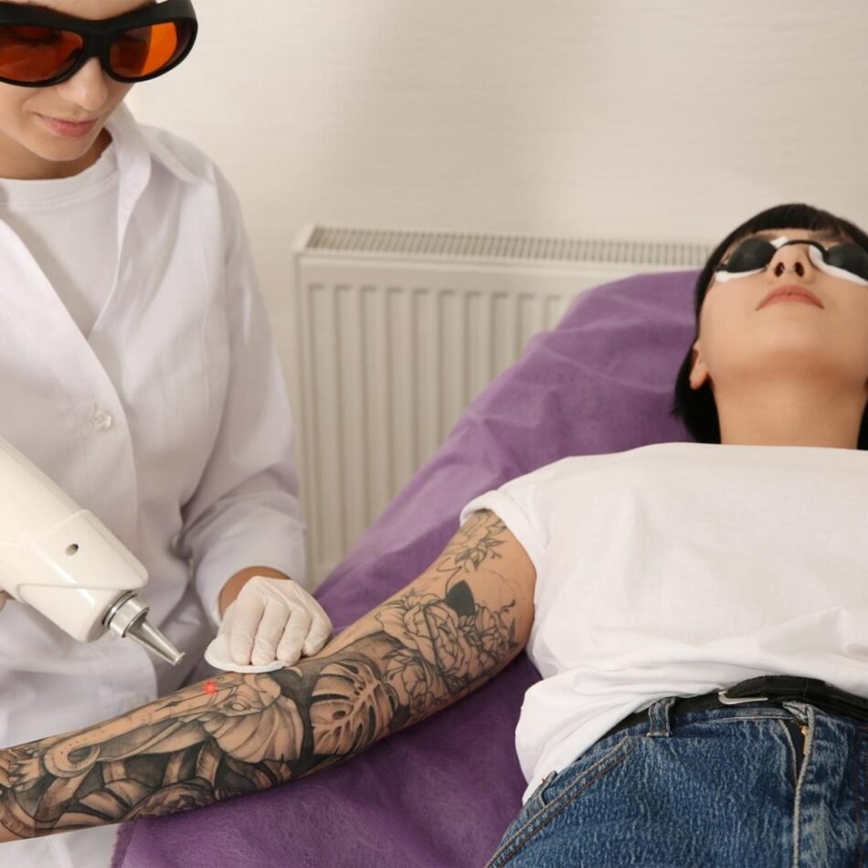 Tatto-Removal-Inkundone