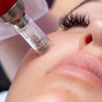 aquagold-facials-fort-collins