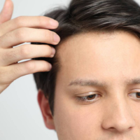 hair-loss-treatment-fort-collins
