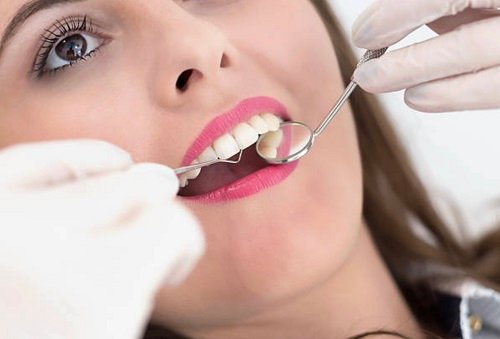 Gum-Disease-Treatment-Auckland