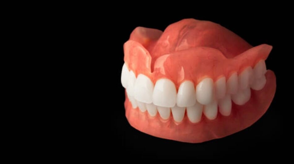 Immediate-Dentures-in-Mount-Roskill
