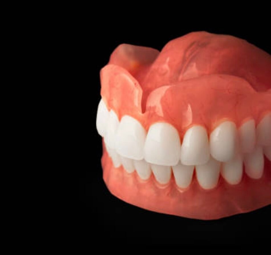 Immediate-Dentures-in-Mount-Roskill