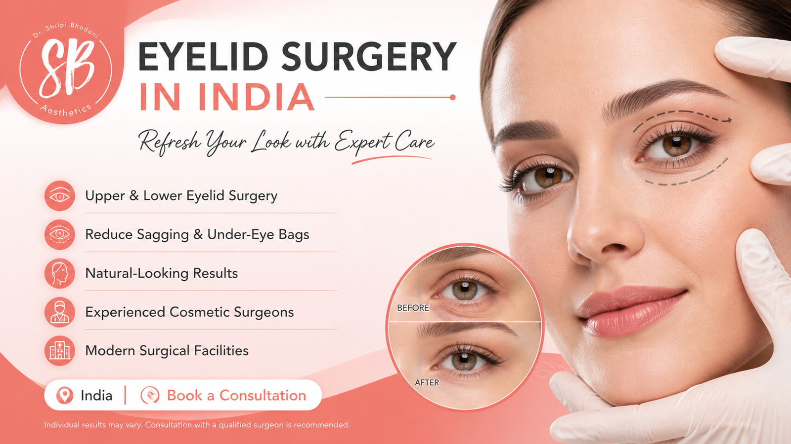 Upper and Lower Eyelid Surgery in India- SB Aesthetics