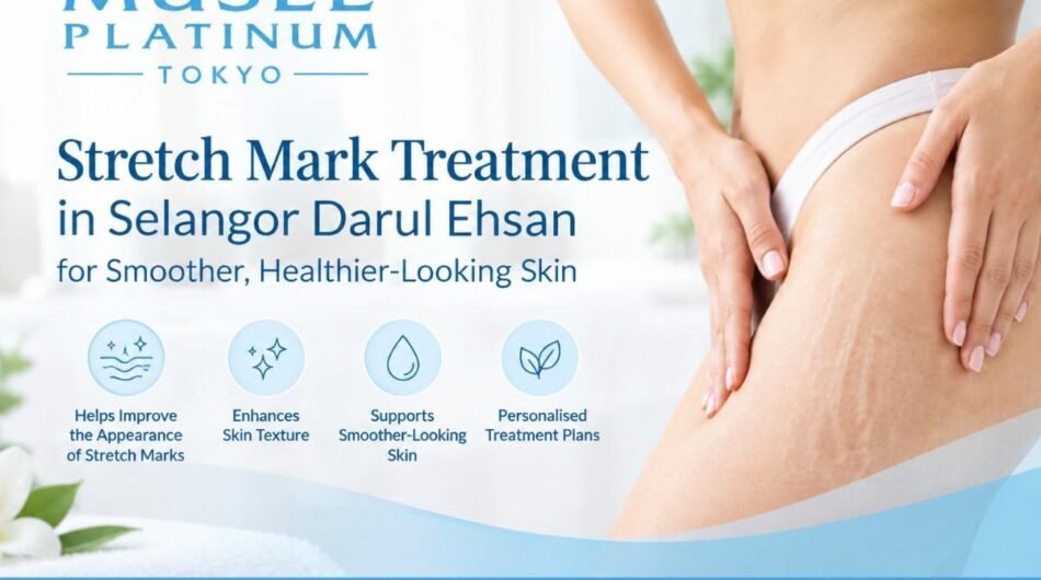 stretch-mark-treatment